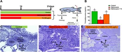 Thyroid Hormones Deficiency Impairs Male Germ Cell Development: A Cross Talk Between Hypothalamic-Pituitary-Thyroid, and—Gonadal Axes in Zebrafish